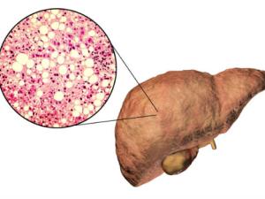 El grupo de investigación Lipids & Liver se centra en el estudio del metabolismo de los lípidos en el hígado, es decir, en las reacciones químicas en las que se forman o se consumen (Kateryna Kon / 123RF).