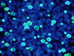 Un antibiótico utilizado en la Unión Soviética es la nueva esperanza contra las superbacterias