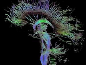 El cerebro tiene neuronas sociales