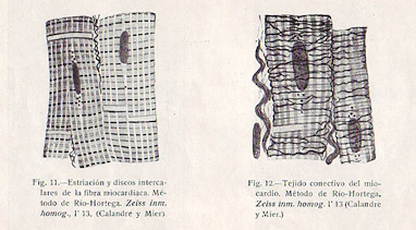 Preparaciones  (Del libro Anatomía y Fisiología Clínicas del Corazón)